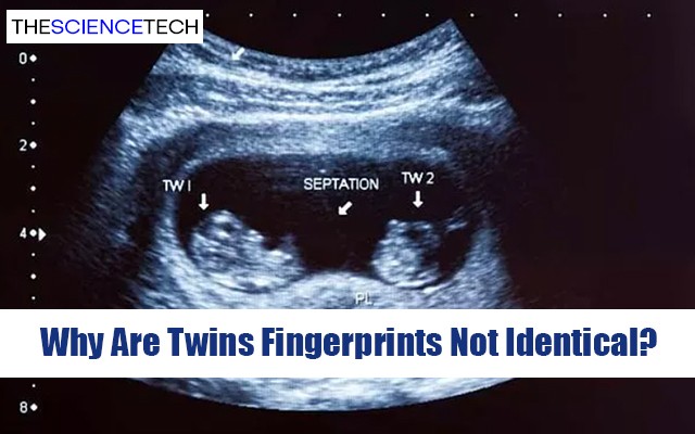 Why Are Twins Fingerprints Not Identical?